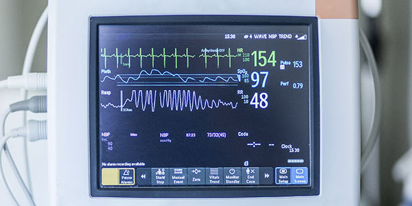 A closeup of an EKG monitor
